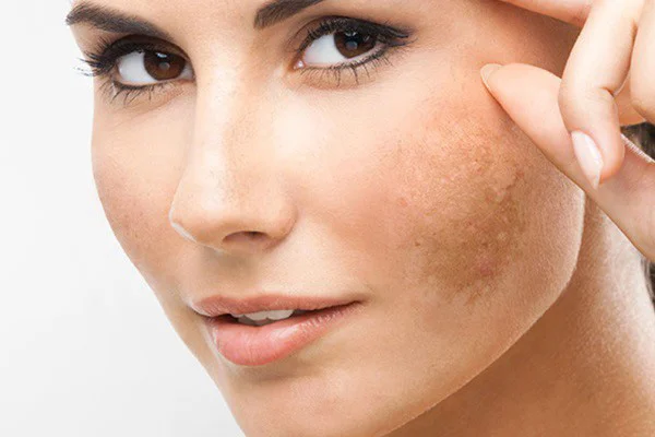 cơ chế hoạt động của hydroquinone