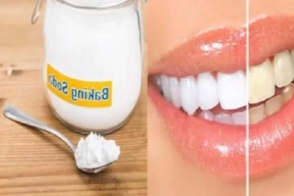 baking soda là gì